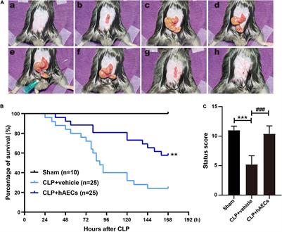 Human <mark class="highlighted">Amnion Epithelial Cells</mark> and Their Derived Exosomes Alleviate Sepsis-Associated Acute Kidney Injury via Mitigating Endothelial Dysfunction